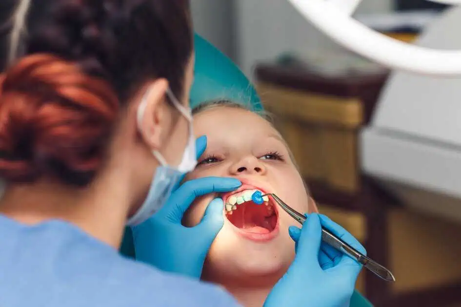 Dental Crowns In Knightsville by Solomon Kids Dentistry