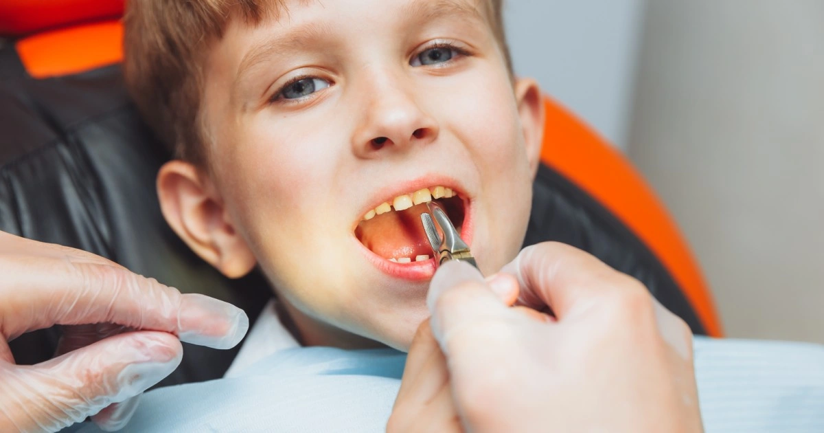 Extractions in Summerville, SC