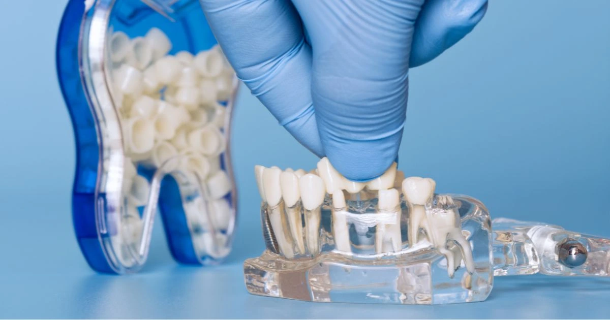 Happy patient after a successful kids dental crown procedure in Summerville, SC.